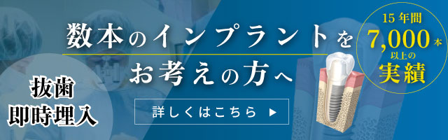 数本のインプラントをお考えの方はこちら